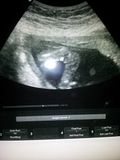 ultrasound 2 20120405_203416.jpg image by smoot559